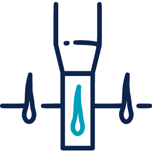 FUE Sapphire Hair Transplant